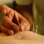 acupuntura-sistemica
